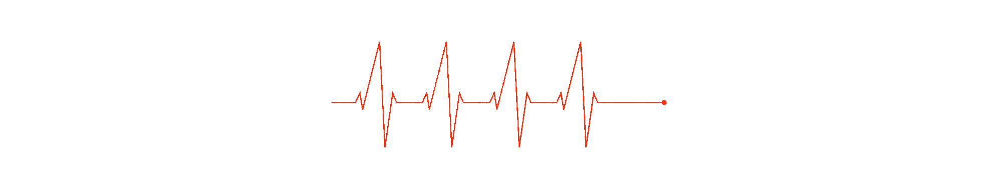 EKG als Praxis-Leistung